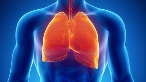 penyebab dan gejala kanker paru paru
